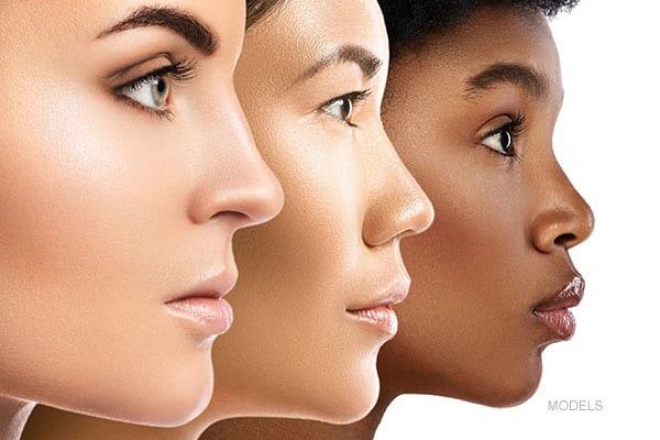 Profile view of three women of different races with sculpted noses