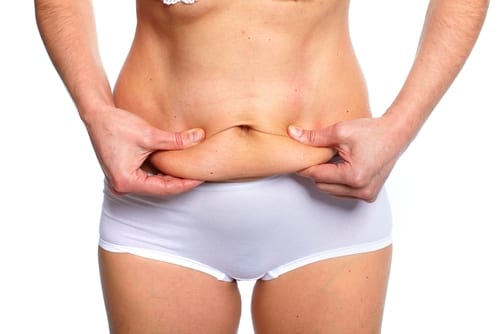 Preparing Yourself for Tummy Tuck Surgery