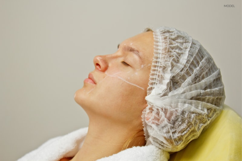 Close up image of woman's face and neck undergoing a cosmetic treatment.