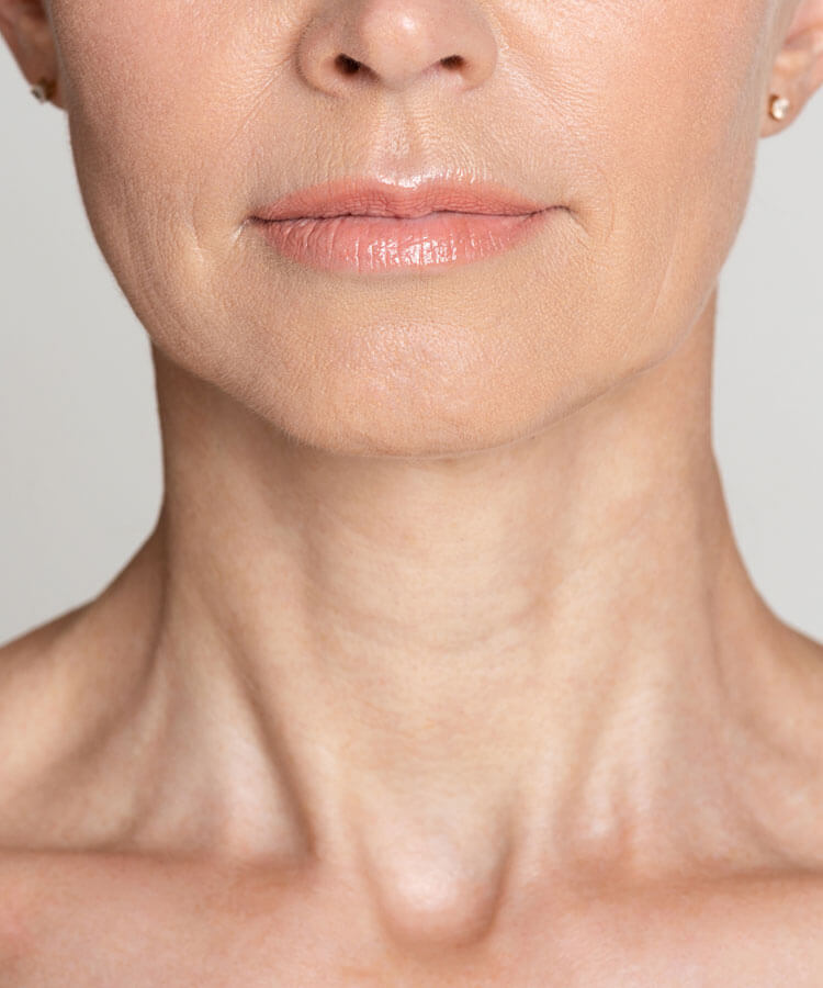 Woman with clear skin showing her neck